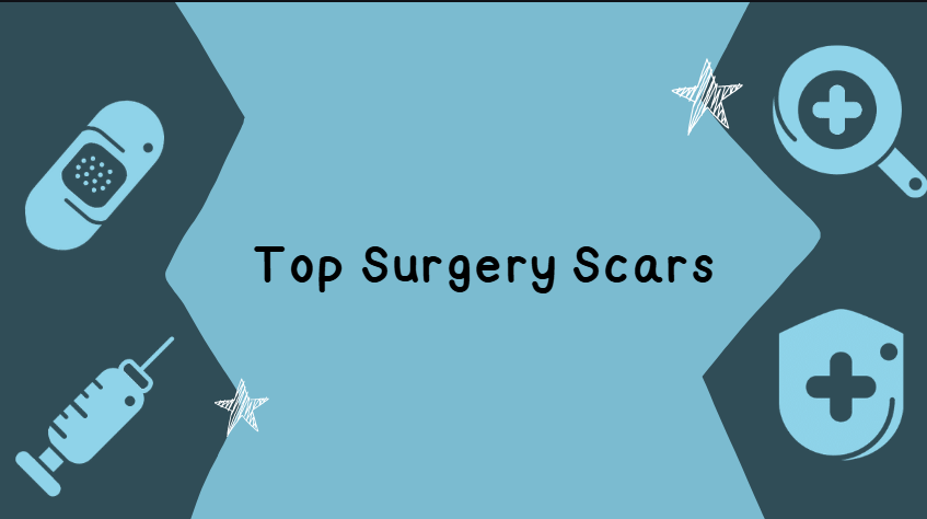 top surgery scars